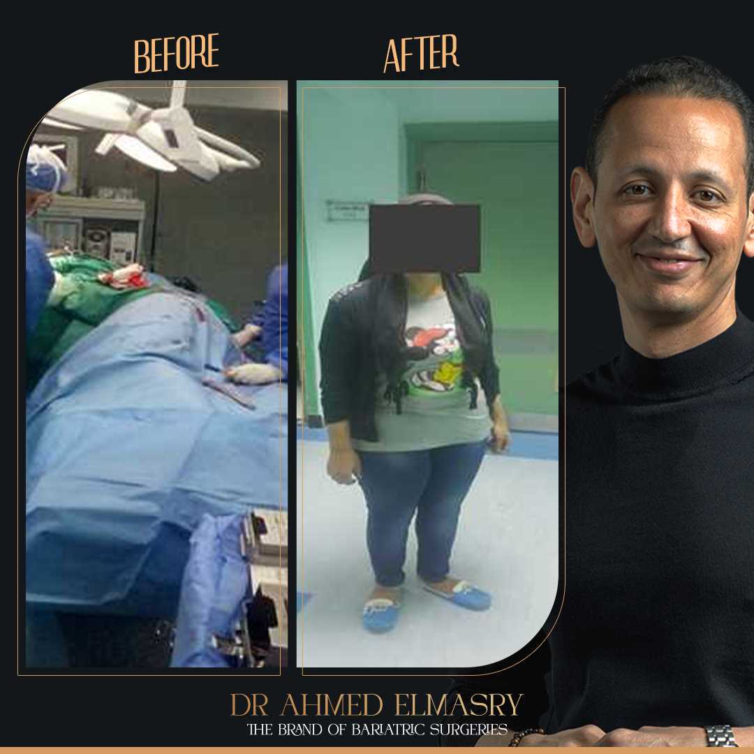 Surgical nurse and gastric sleeves with Dr.Ahmed